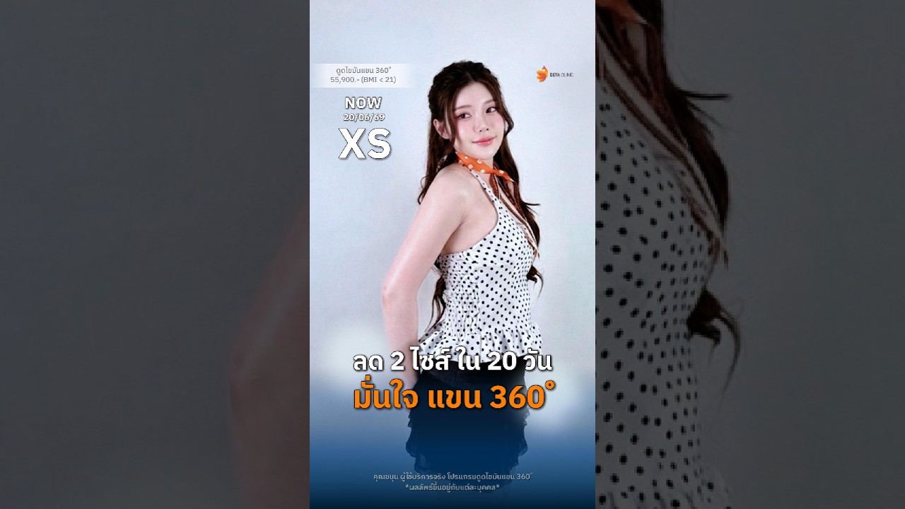 รีวิวจากคนไข้จริง เปลี่ยนไซส์ชุดกระชับจาก M สู่ XS ใน 20 วัน