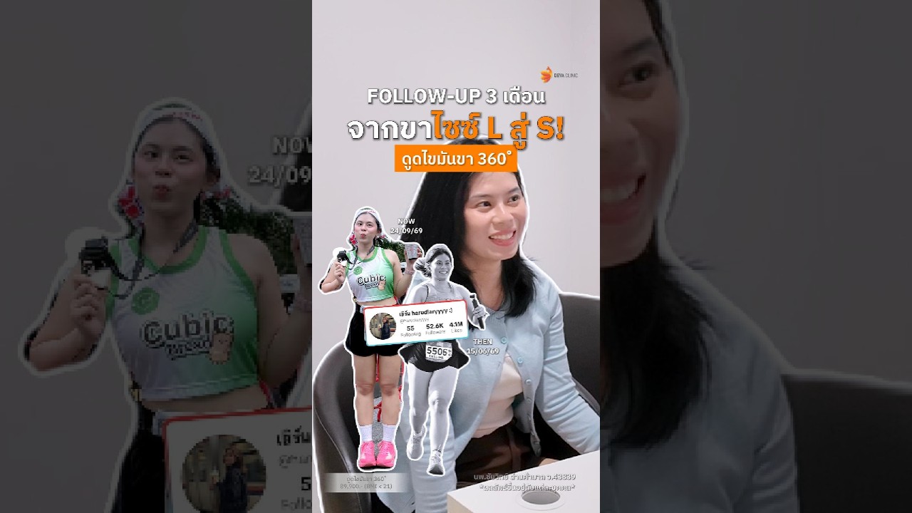 ขาเบียด ขาใหญ่ ใส่ชุดไหนก็ไม่มั่นใจ... เปลี่ยนจากไซส์ L สู่ S ใน 3 เดือน หลัง "ดูดไขมันขา 360°"