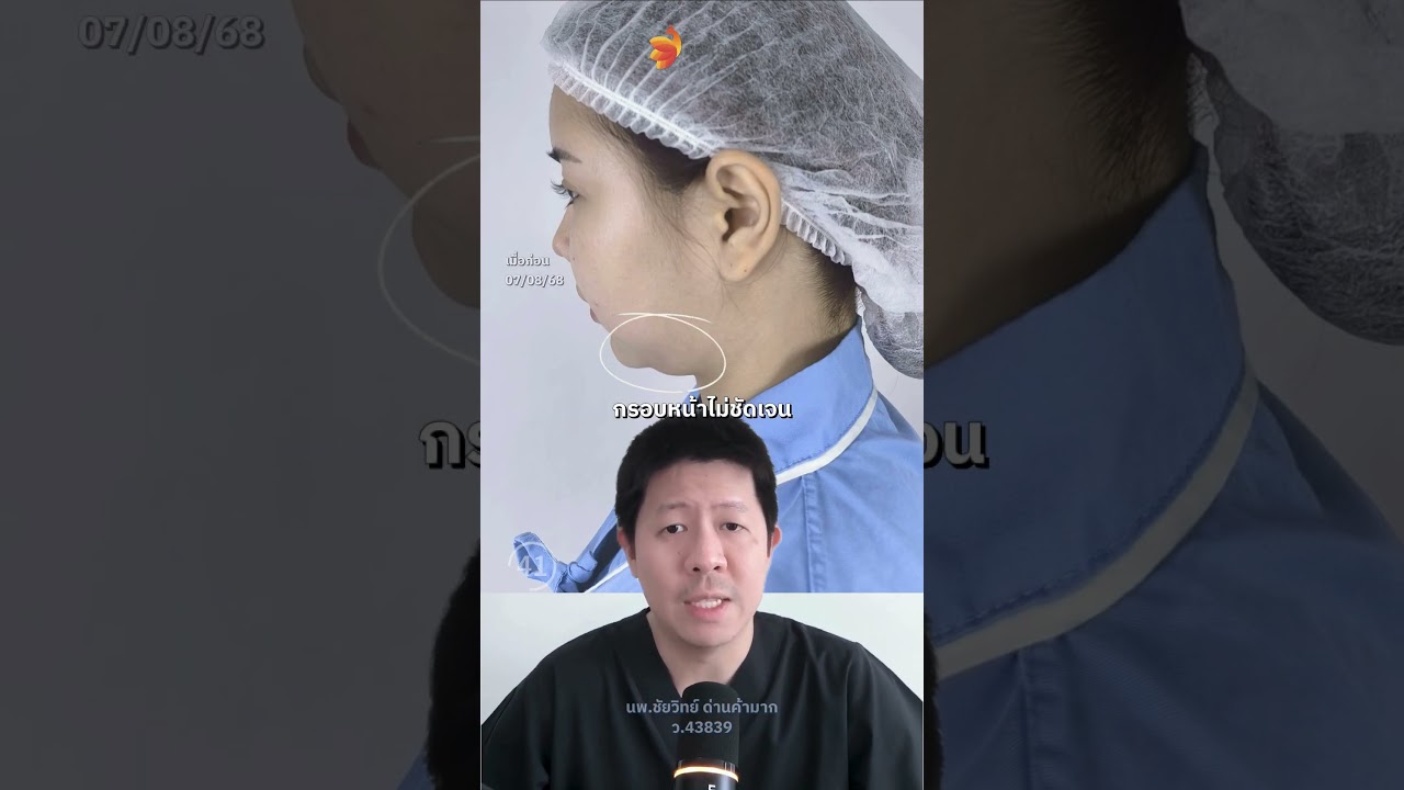 60 วินาที รู้เรื่อง เคล็ดลับหน้าเรียวแบบไร้แผล คลิปนี้มีคำตอบใน 1 นาที