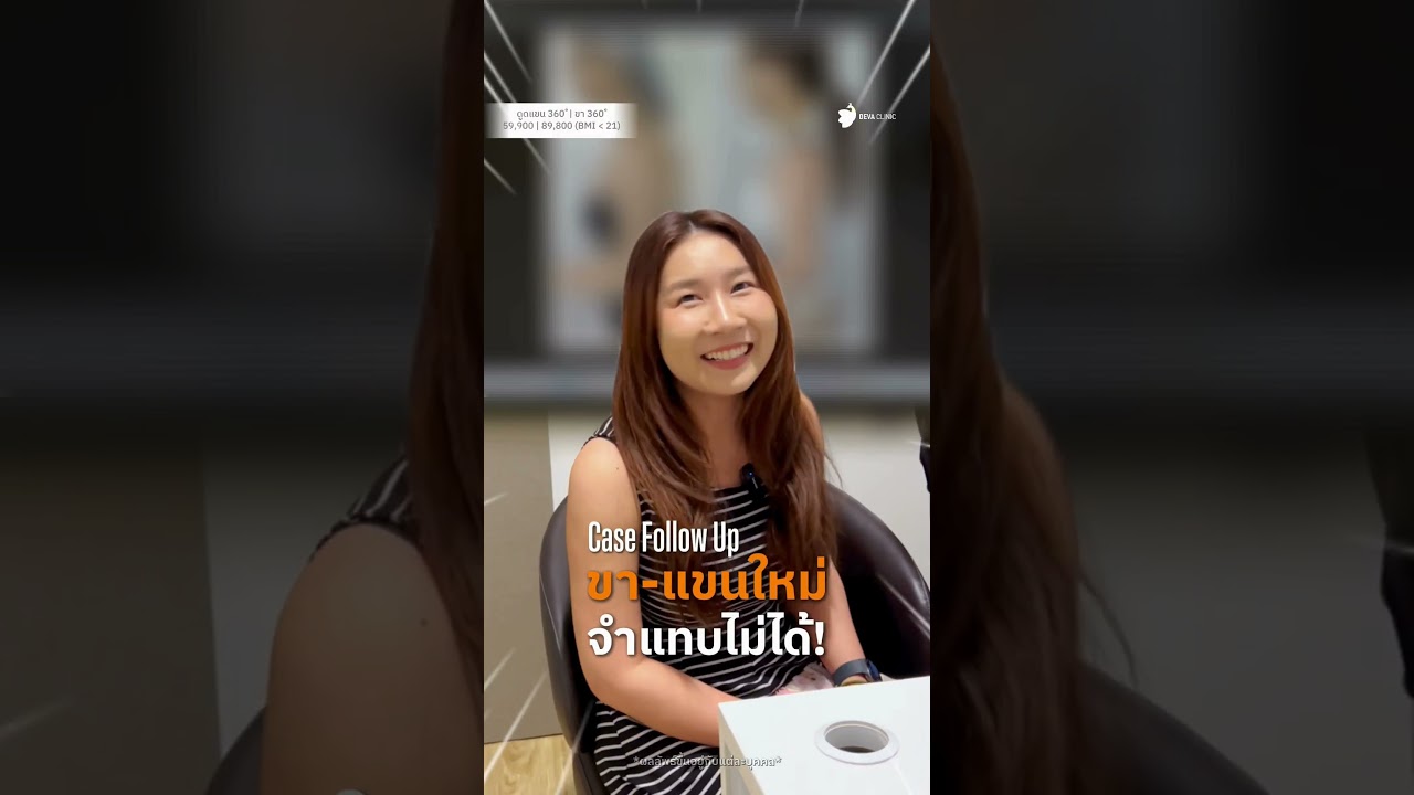 เคสรีวิว คุณอีฟ 3 เดือน สรุปชัด! ดูดไขมันแขน 360° + ขา 360°