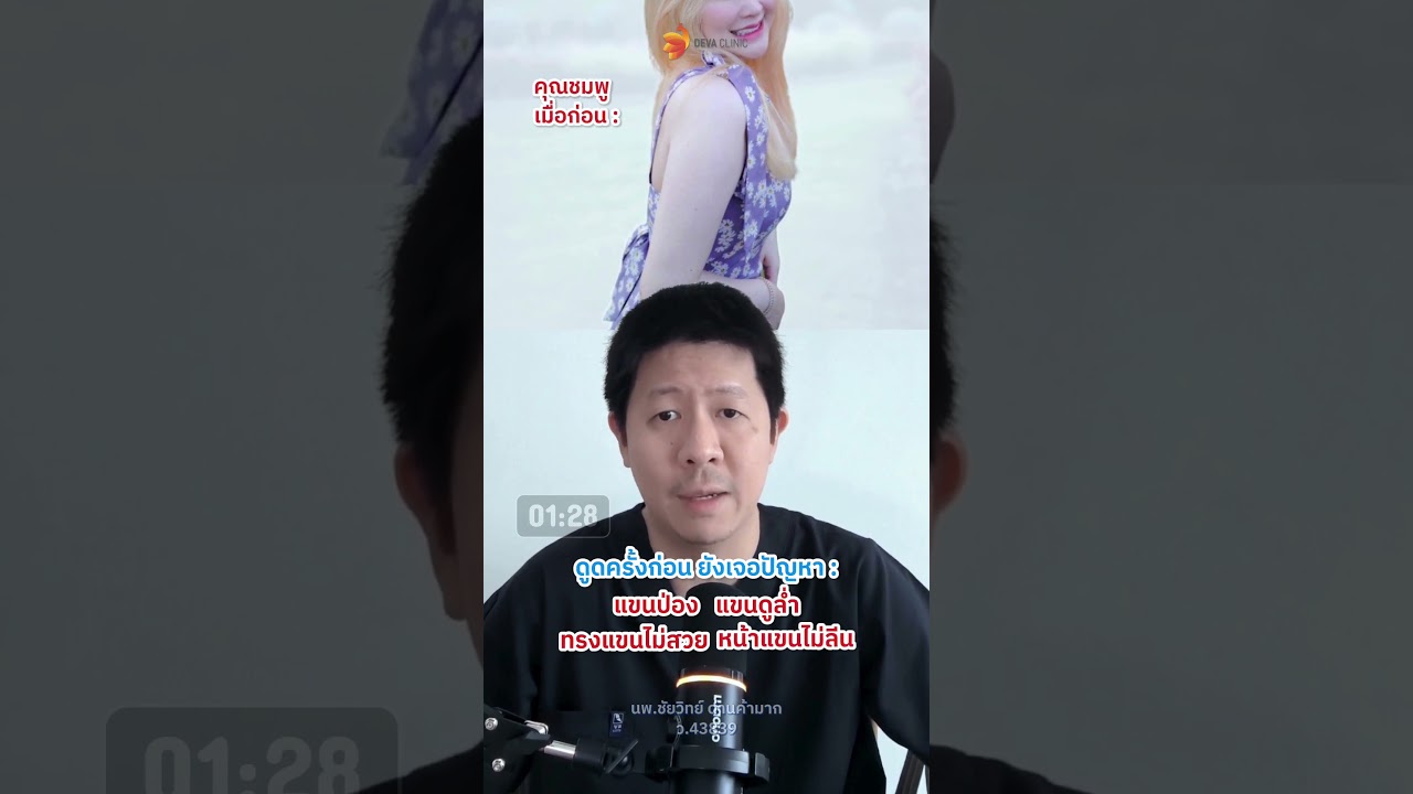 สิ่งที่ท่านจะต้องเจอแน่ๆ ถ้าไม่ดูดแขนแบบ 360 องศา !