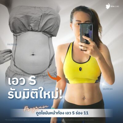 ร่อง 11 มิติใหม่