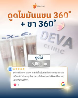รีวิวจากคนไข้ 2 ดูดไขมันเจ็บไหม