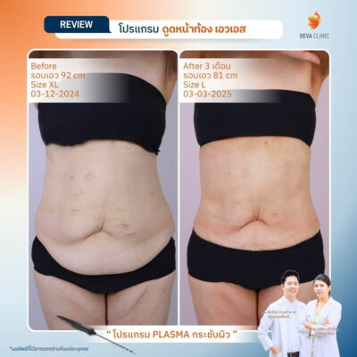 รีวิว J plasma 10