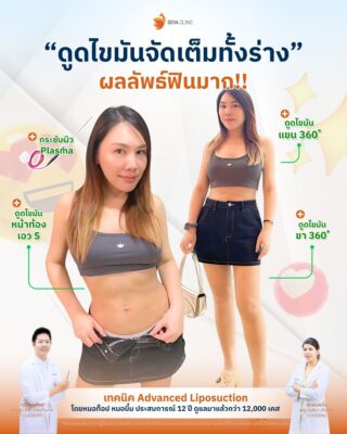 รีวิว J plasma คุณกอล์ฟ