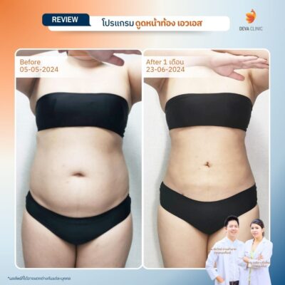 รีวิวทางการแพทย์ท้อง 6