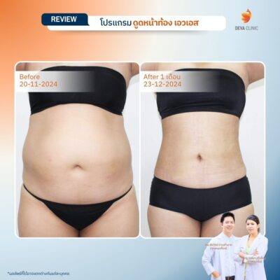 รีวิวทางการแพทย์ท้อง 2