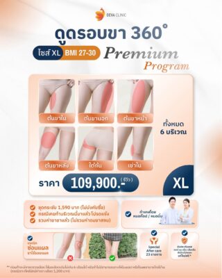 ราคาต้นขา4
