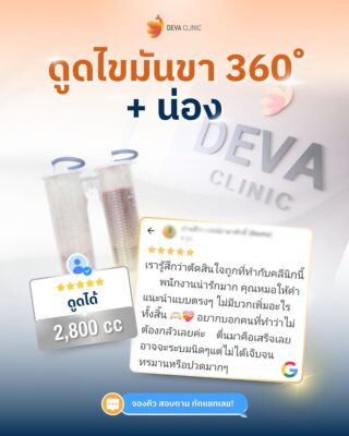 รีวิว GG map 4