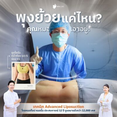 ร่อง 11 คุณโม