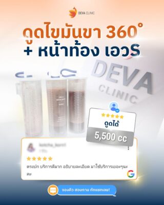 รีวิว GG map 6