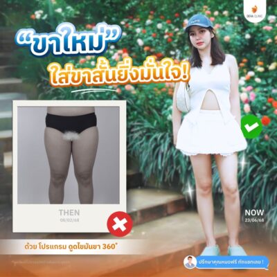 รีวิวต้นขาทางบ้าน 7