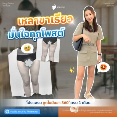 รีวิวต้นขาทางบ้าน 8