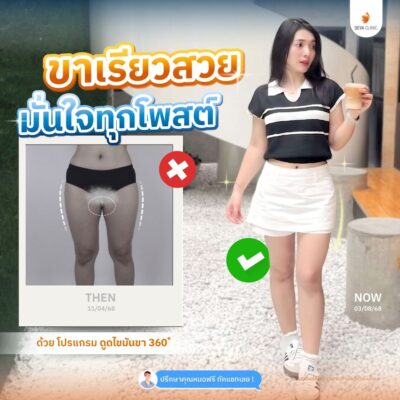 รีวิวต้นขาทางบ้าน 11