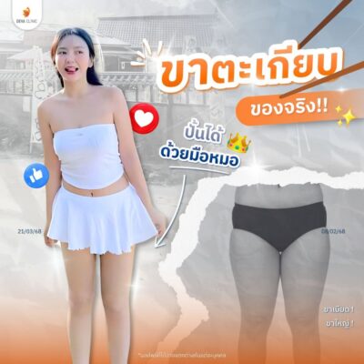 รีวิวต้นขาทางบ้าน 6