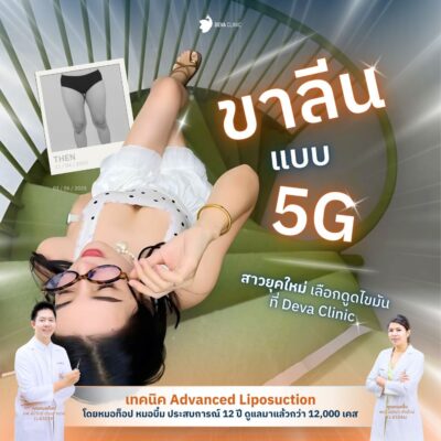 รีวิวต้นขาทางบ้าน 3