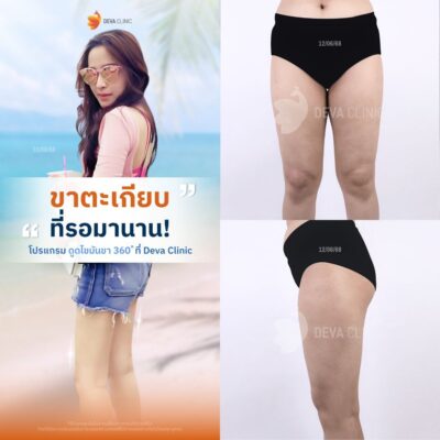 รีวิวต้นขาทางบ้าน 5