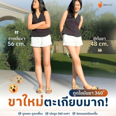 รีวิวต้นขาทางบ้าน 2