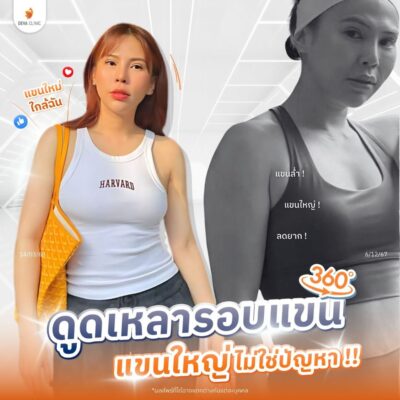 รวมรีวิวดูดแขน 2