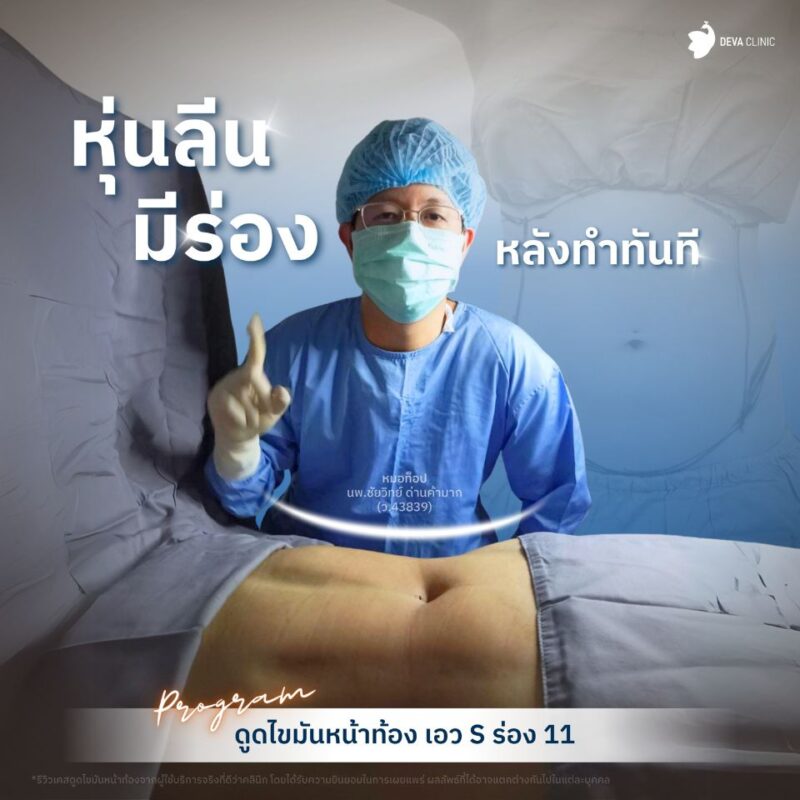 หลังทำทันที ดูดไขมันร่อง 11