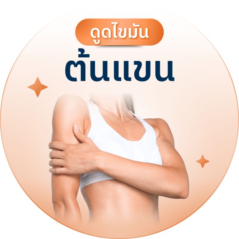 ดูดไขมันต้นแขน