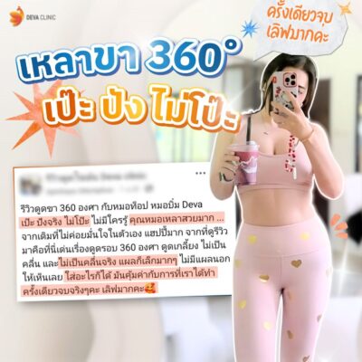 รีวิวความประทับใจต้นขา 5