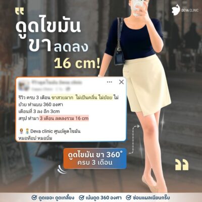 รีวิวความประทับใจต้นขา 1