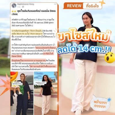 รีวิวความประทับใจต้นขา 10