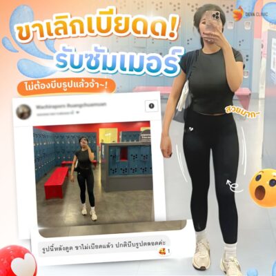 รีวิวความประทับใจต้นขา 11