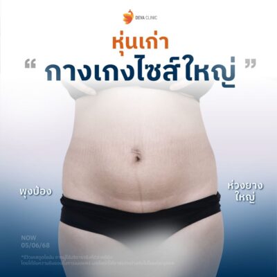 ก่อนทำ คุณอัง