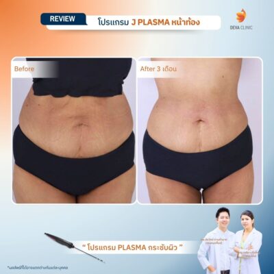 รีวิว J plasma 2