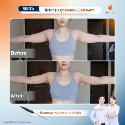 รีวิว J plasma 6