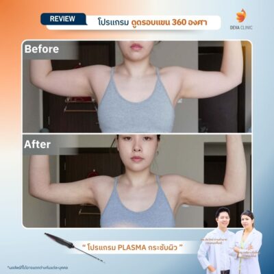 รีวิว J plasma 3