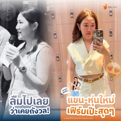 รวมรีวิวดูดแขน คลินิกดูดไขมัน 6