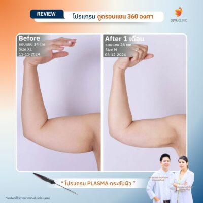 รีวิว J plasma 19