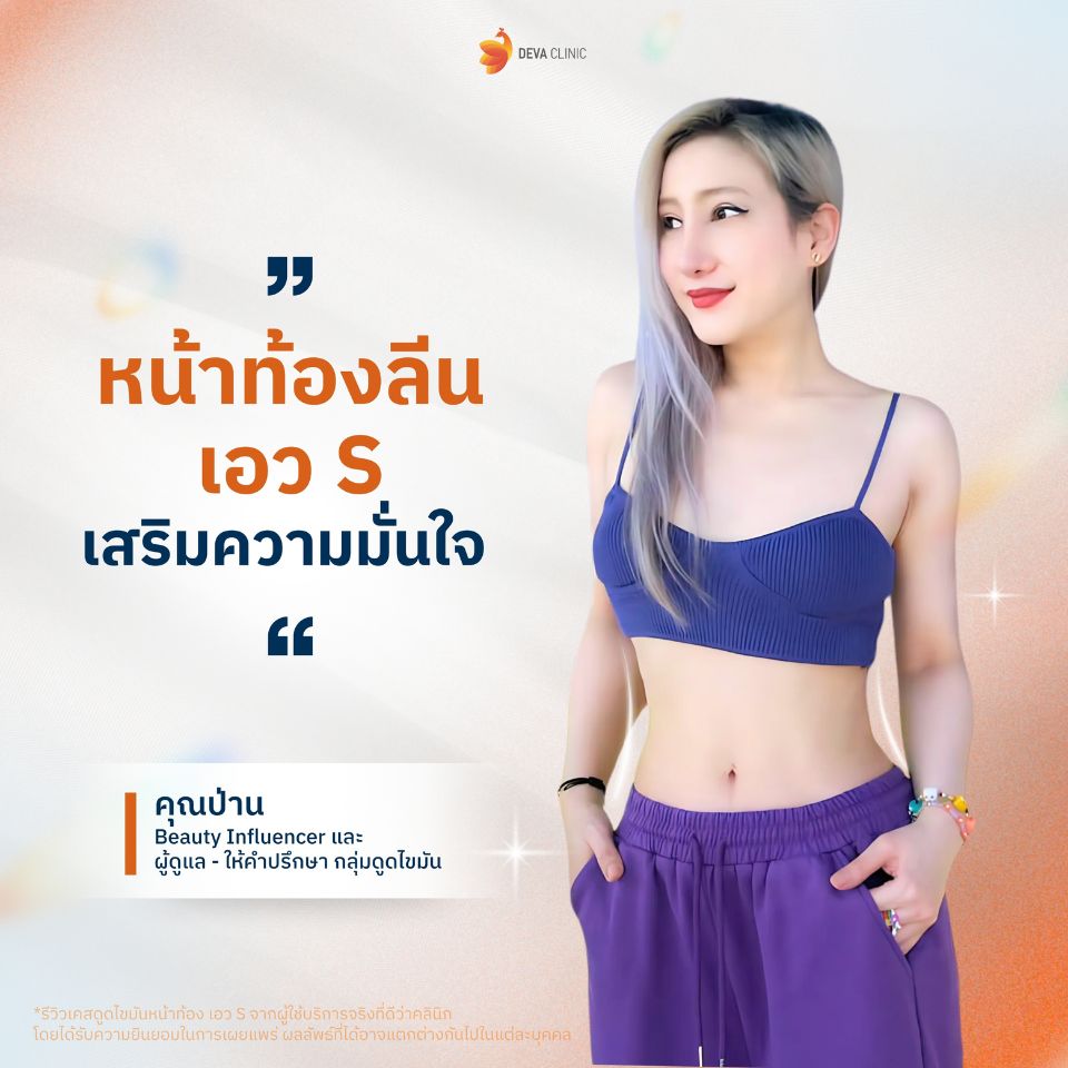 รีวิวความประทับใจดูดไขมันหน้าท้อง 2