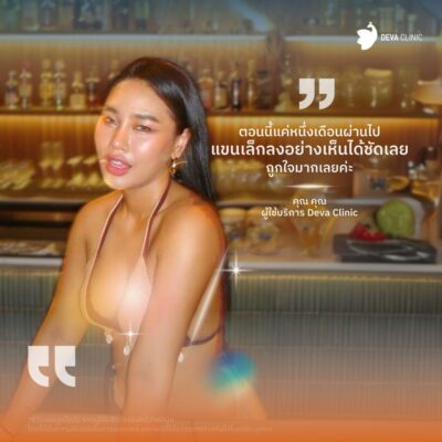 รีวิวความประทับใจแขน 2
