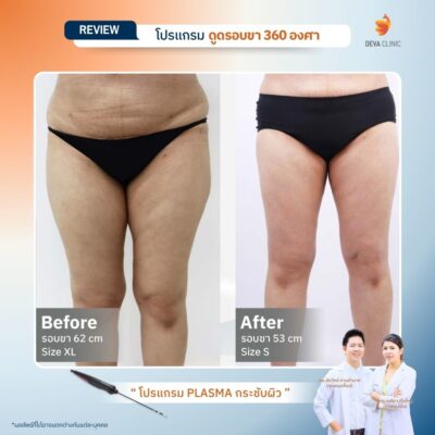 รีวิว J plasma 11