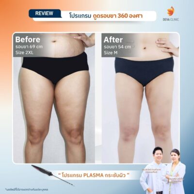 รีวิว J plasma 15