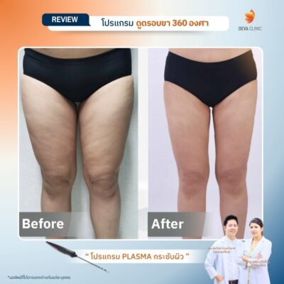 รีวิว J plasma 5