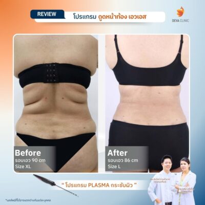 รีวิว J plasma 12