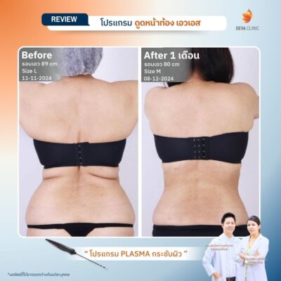 รีวิว J plasma 8