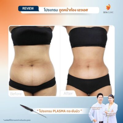 รีวิว J plasma 7