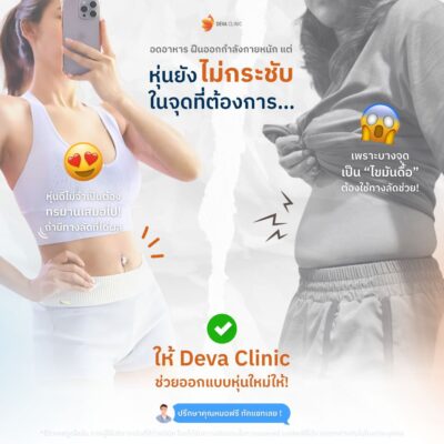 รีวิวดูดไขมันหน้าท้อง คลินิกดูดไขมัน 2