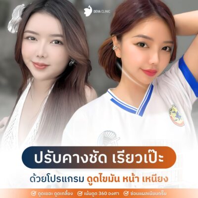 รีวิวดูดไขมันเหรียง คลินิกดูดไขมัน 2