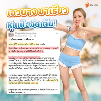 รีวิวความประทับใจต้นขา 12