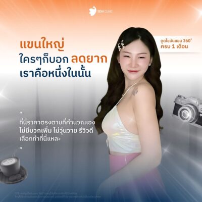 รีวิวความประทับใจแขน 3