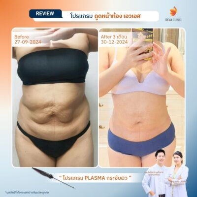 รีวิว J plasma 1