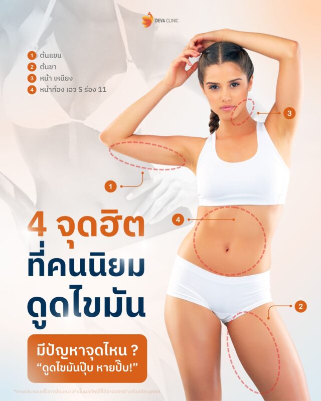 บริเวณที่นิมยมดูดไขมัน