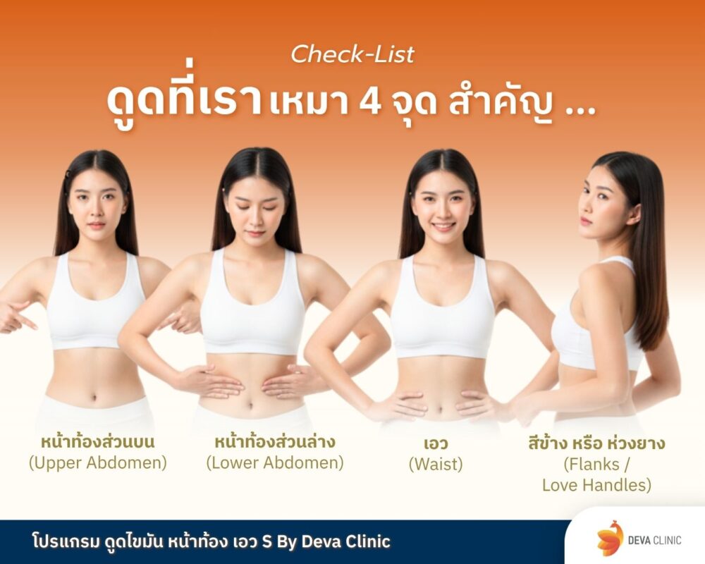 ดูดไขมันหน้าท้อง เหมา 4 จุด